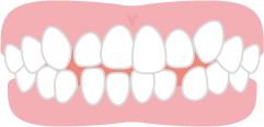 ガタガタの歯並びのイメージ