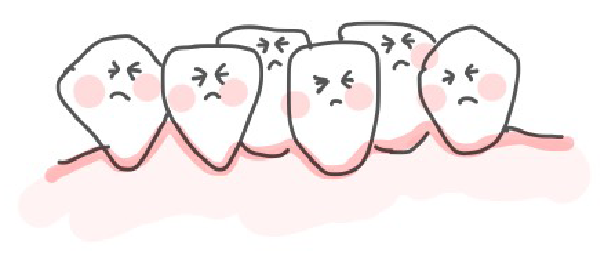 大人の歯がガタガタしている時のイラスト表現