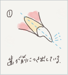 歯が前に突き出しているイラスト