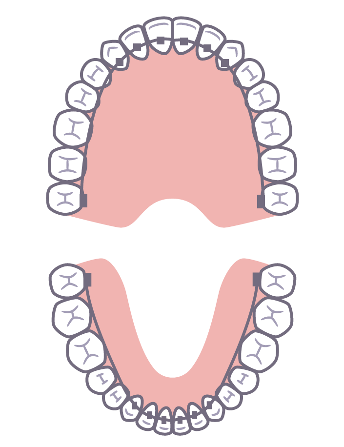 上顎と下顎の歯並び